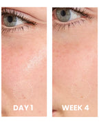 Anti-Acne Clarifying Serum texture close-up
Elaris7 breakout control serum