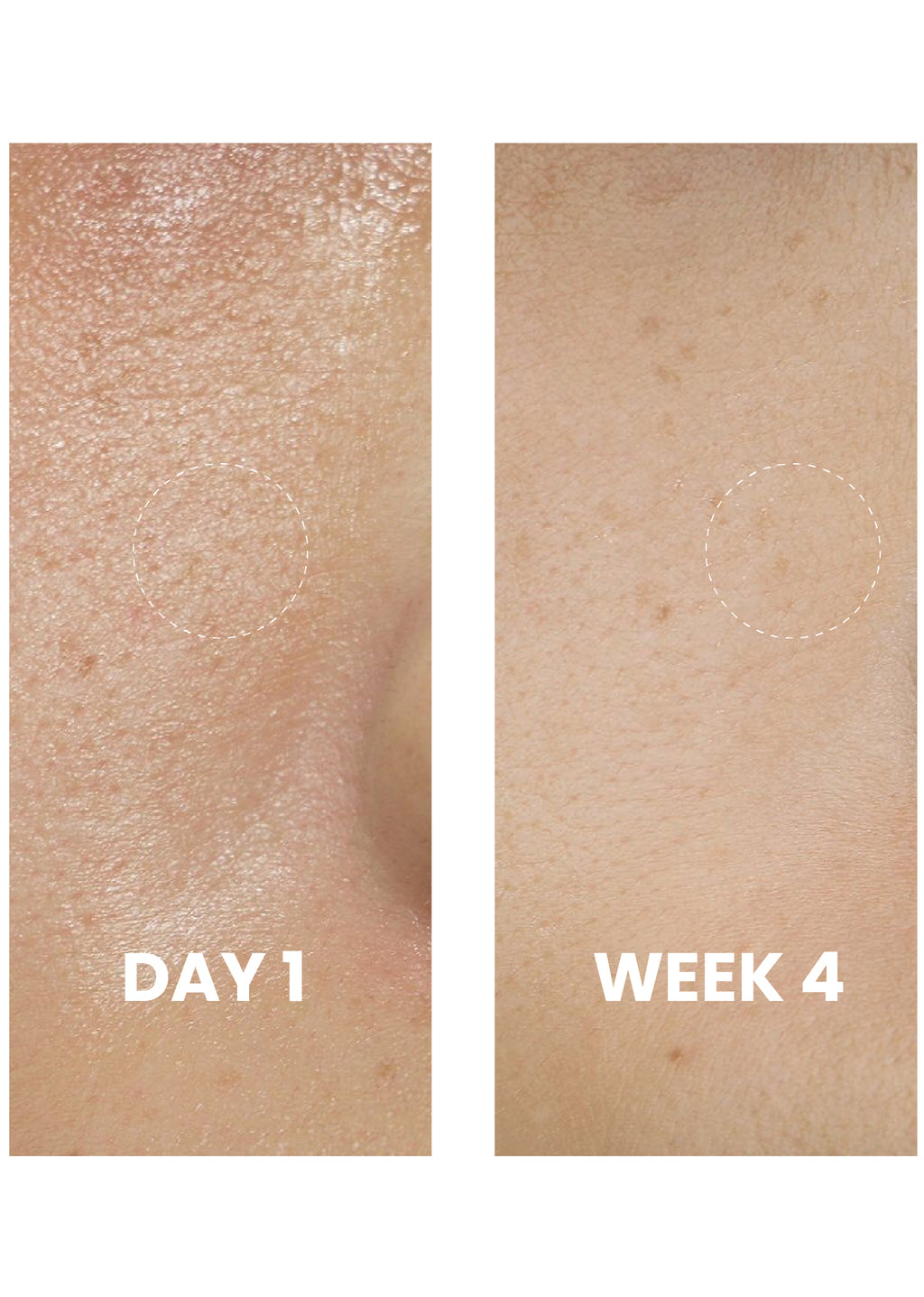 Brightening Gel Cleanser texture close-up
Elaris7 gentle daily cleanser