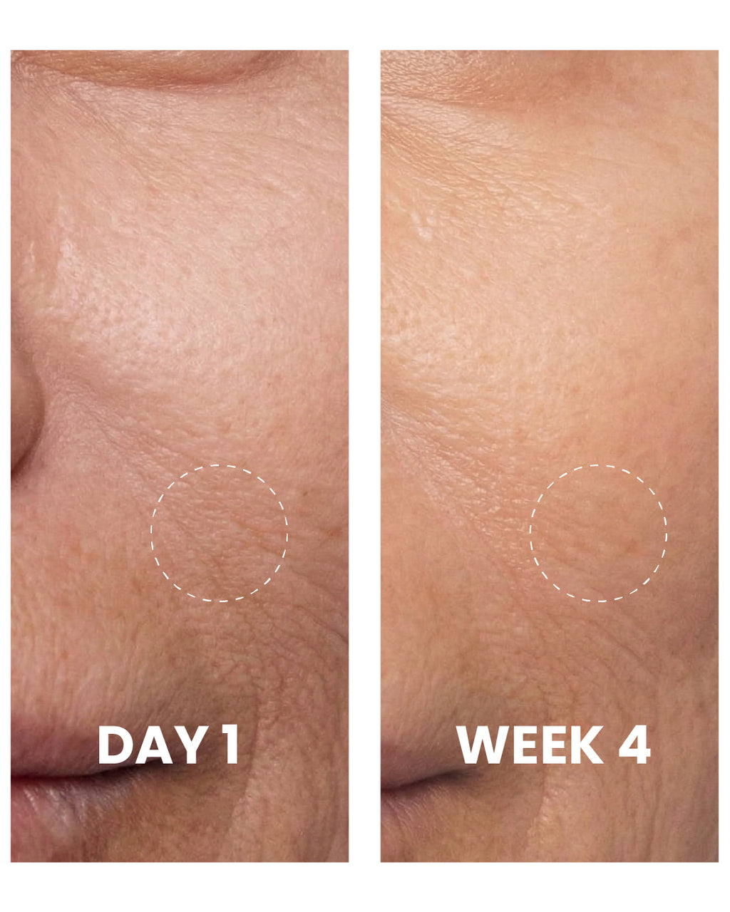 Glutathione cream texture close-up
Elaris7 glow and repair skincare