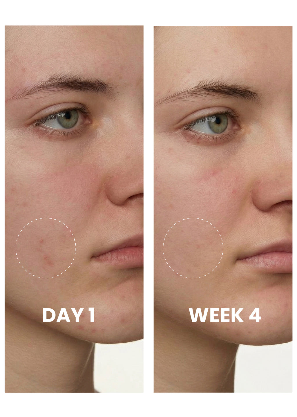 Tranexamic Brightening Serum texture close-up
Elaris7 fade spots reveal clarity serum