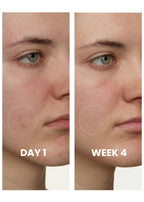Tranexamic Brightening Serum texture close-up
Elaris7 fade spots reveal clarity serum