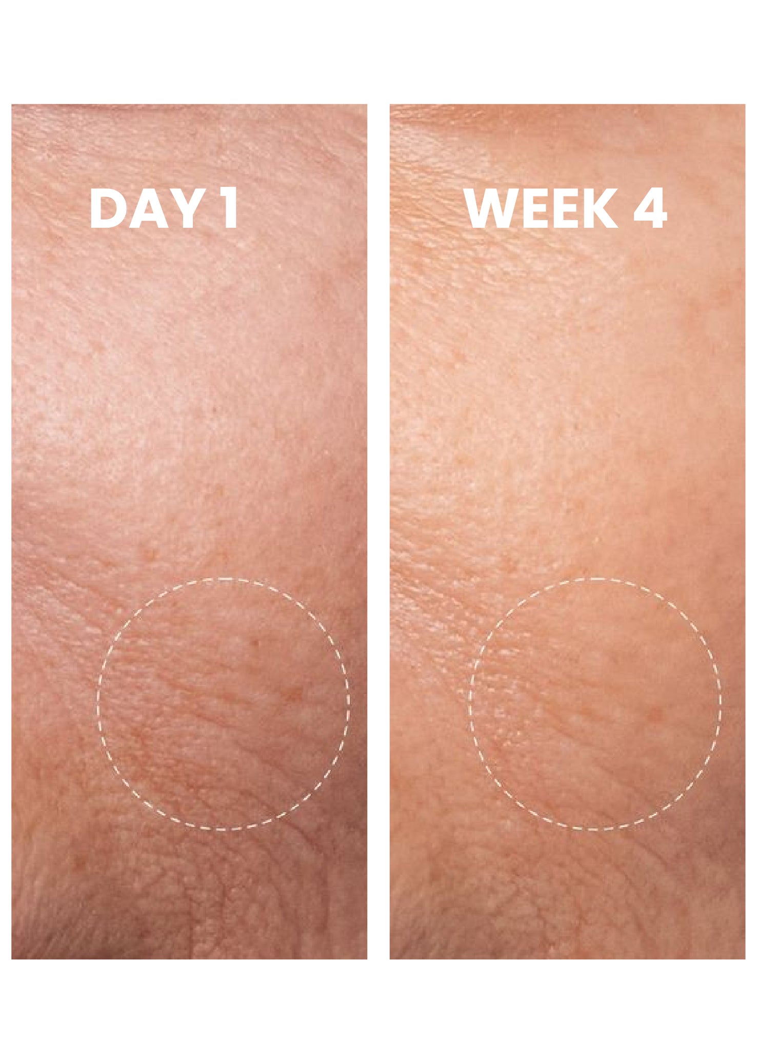 Centella Moisturizer  Daily Dew