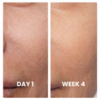 Centella Serum  Radiance Reset