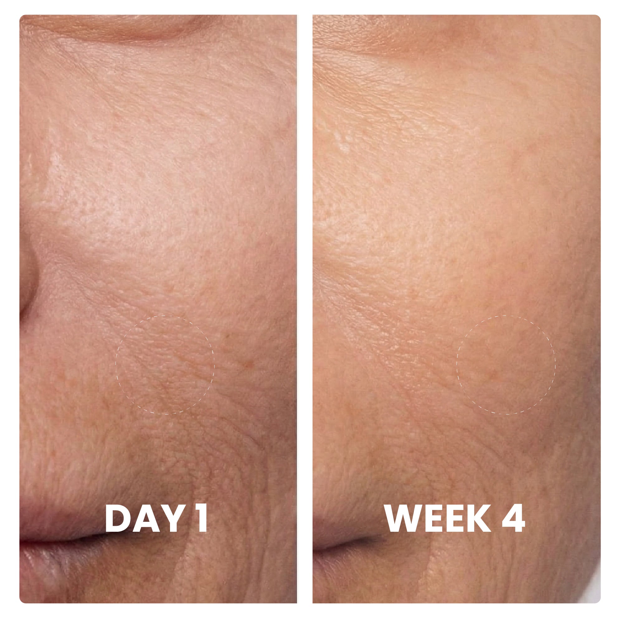 Centella Serum  Radiance Reset